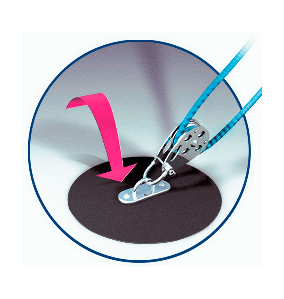 SPEED GRIP Antideslizante